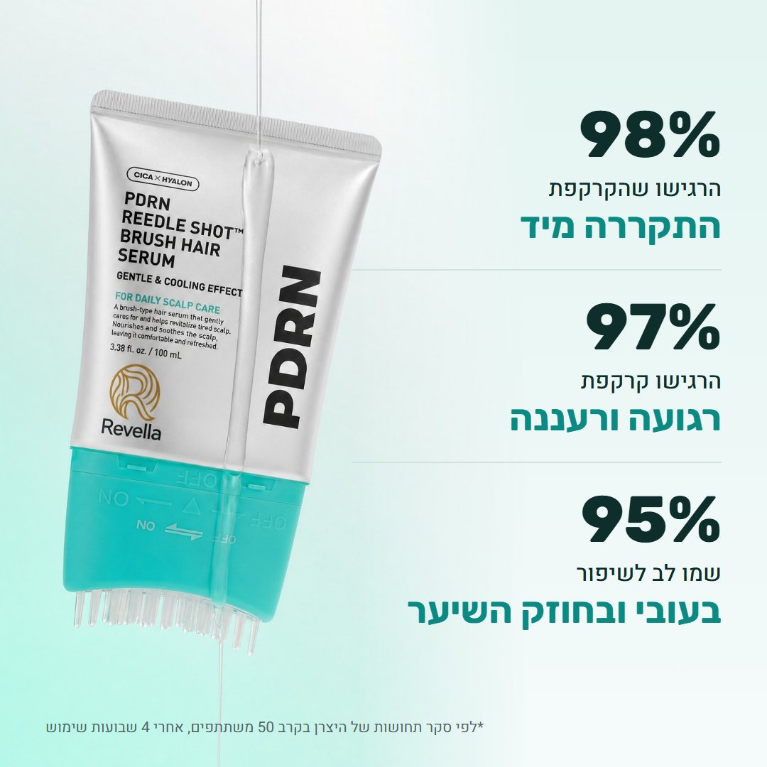 תוצאות סקר התחושות של היצרן
